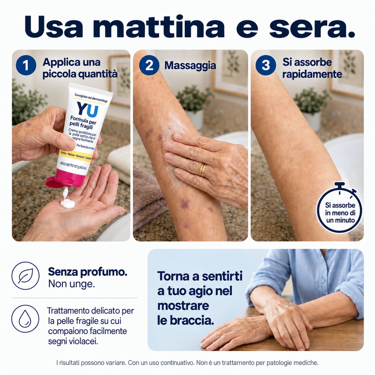 Crema anti-lividi per pelli fragili