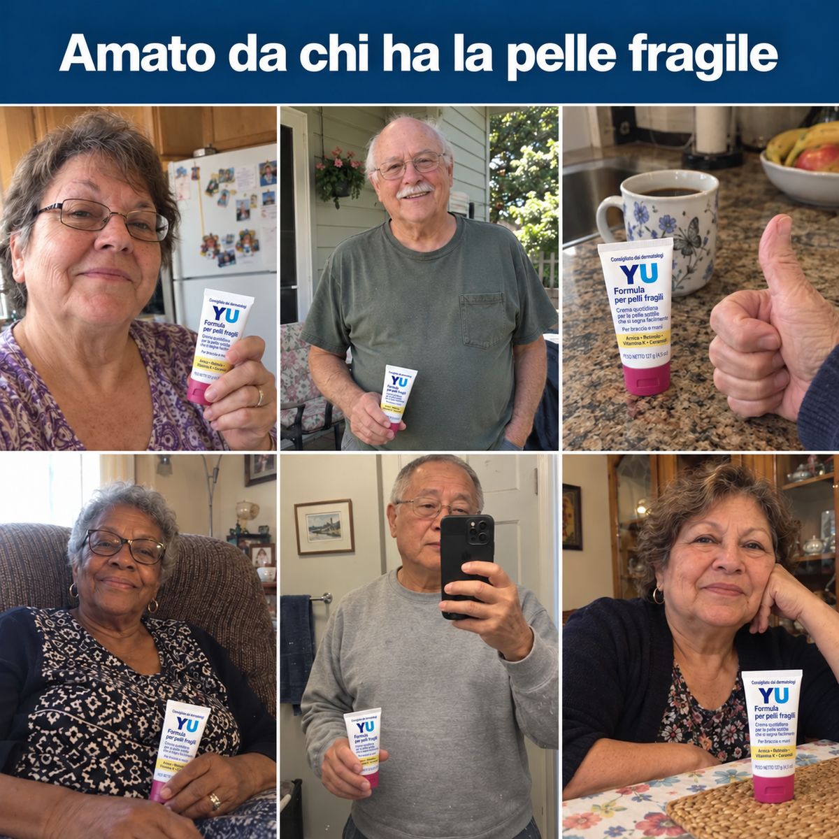 Crema anti-lividi per pelli fragili