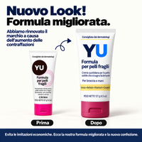 Crema anti-lividi per pelli fragili
